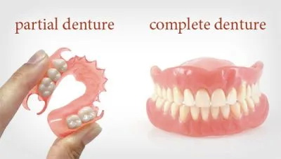 complete-partial-dentures-400x227-608w